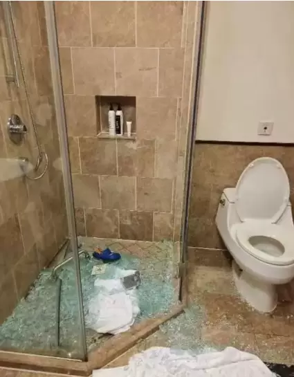 惠州酒店玻璃爆裂伤童